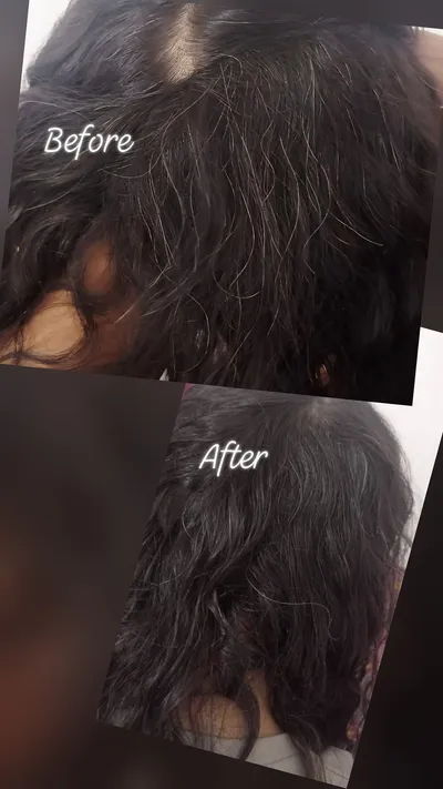 Hair treatment before and after result