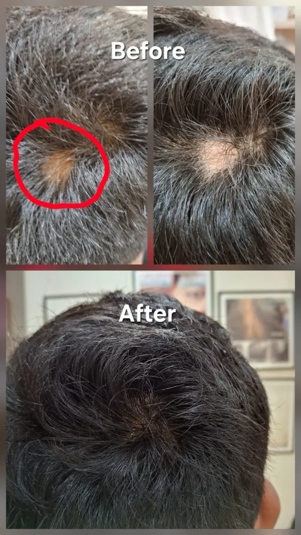 Hair treatment result