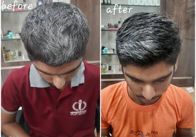 White hair treatment before and after result